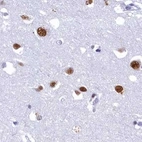 Immunohistochemical staining of human cerebral cortex using Anti-SUGP2 antibody HPA041557.