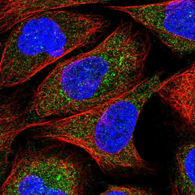 Anti-ZNF720 Antibody