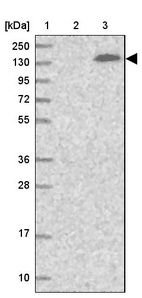 Lane 1: Marker [kDa] 250, 130, 95, 72, 55, 36, 28, 17, 10_br/_Lane 2: Human cell line RT-4_br/_Lane 3: Human cell line U-251MG sp