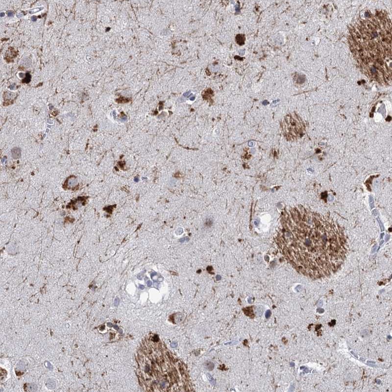 Anti-C16orf72 Antibody