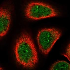 Immunofluorescent staining of human cell line A-431 shows localization to nucleoplasm & nuclear bodies.