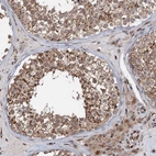 Anti-TMA16 Antibody