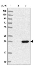 Anti-TMA16 Antibody