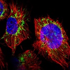 Immunofluorescent staining of human cell line U-251 MG shows localization to mitochondria.