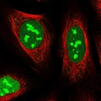 Immunofluorescent staining of human cell line U-2 OS shows localization to nucleus & nucleoli.