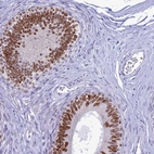 Immunohistochemical staining of human epididymis shows strong nuclear positivity in glandular cells.
