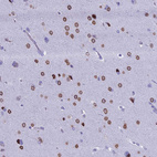 Immunohistochemical staining of human cerebral cortex shows strong nuclear membrane positivity in neuronal cells.