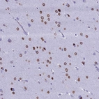 Immunohistochemical staining of human cerebral cortex shows strong nuclear membrane positivity in neuronal cells.