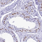 Immunohistochemical staining of human testis shows strong nuclear positivity in cells in seminiferous ducts.