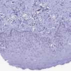 Immunohistochemical staining of human skin shows no positivity in squamous epithelial cells as expected.