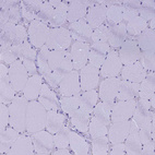 Immunohistochemical staining of human skeletal muscle shows no positivity in myocytes as expected.