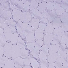 Immunohistochemical staining of human skeletal muscle shows no positivity in myocytes as expected.