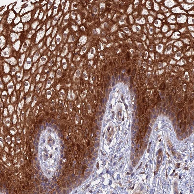 Anti-TSPAN16 Antibody