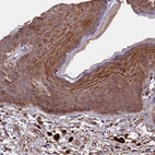 Anti-DUOXA1 Antibody