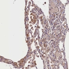 Immunohistochemical staining of human lung shows strong cytoplasmic positivity in macrophages.