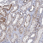 Anti-TMEM221 Antibody