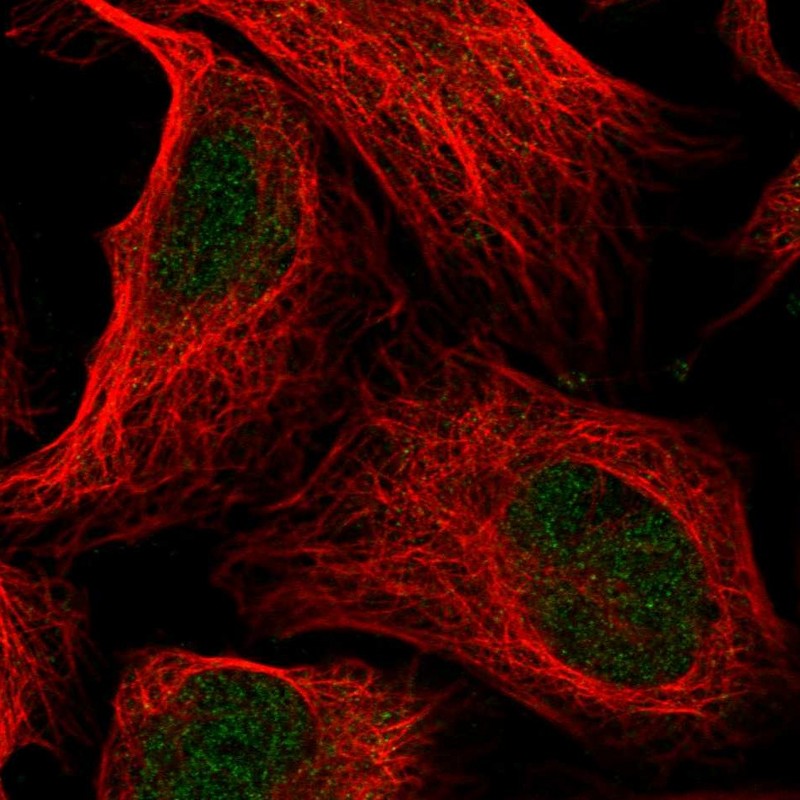 Anti-ANKRD11 Antibody
