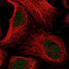 Anti-ANKRD11 Antibody