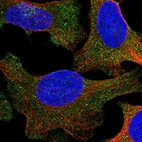 Immunofluorescent staining of human cell line U-2 OS shows localization to cytosol.