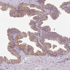 Immunohistochemical staining of human prostate shows moderate granular cytoplasmic positivity in glandular cells.