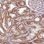 Immunohistochemical staining of human kidney shows moderate granular cytoplasmic positivity in cells in tubules.
