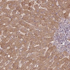 Immunohistochemical staining of human liver shows moderate positivity in cytoplasm granular in hepatocytes.