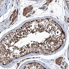 Anti-MDM1 Antibody