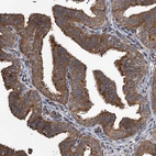 Immunohistochemical staining of human fallopian tube shows strong cytoplasmic positivity in glandular cells.