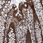 Immunohistochemical staining of human rectum shows strong cytoplasmic positivity in glandular cells.