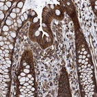 Immunohistochemical staining of human rectum shows strong cytoplasmic positivity in glandular cells.