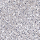 Immunohistochemical staining of human liver shows negative to very weak cytoplasmic positivity in hepatocytes.