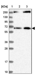 Lane 1: Marker [kDa] 250, 130, 95, 72, 55, 36, 28, 17, 10_br/_Lane 2: Human cell line RT-4_br/_Lane 3: Human cell line U-251MG sp