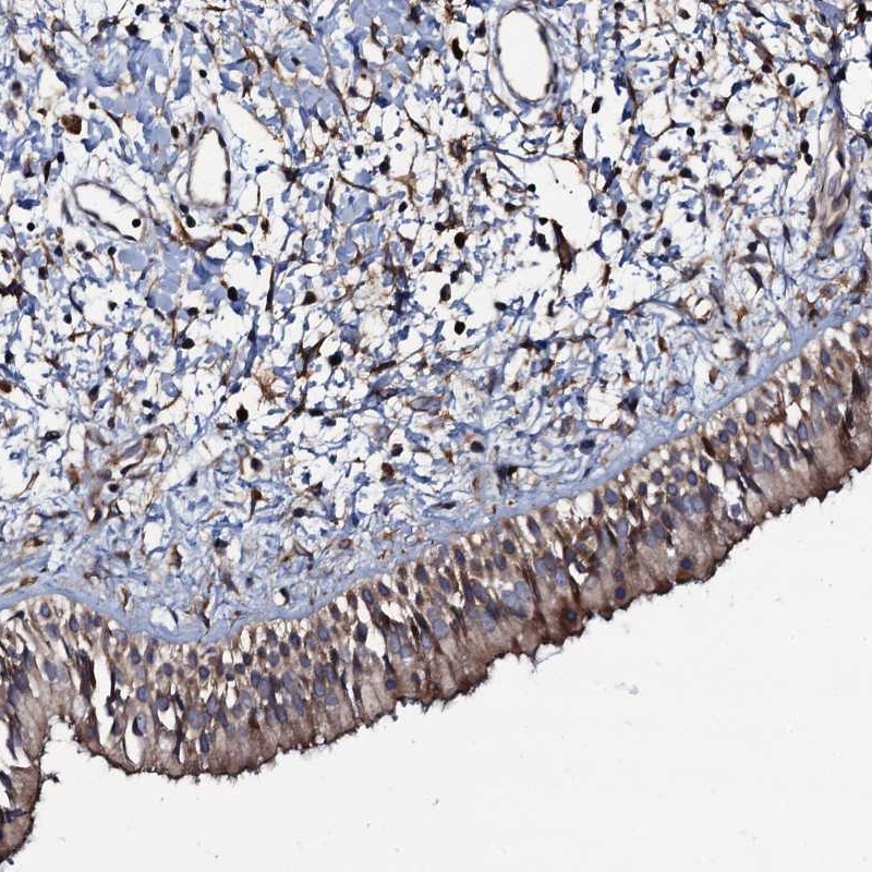 Anti-KXD1 Antibody