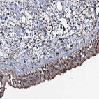 Anti-KXD1 Antibody