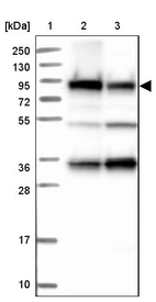 Lane 1: Marker [kDa] 250, 130, 95, 72, 55, 36, 28, 17, 10_br/_Lane 2: Human cell line RT-4_br/_Lane 3: Human cell line U-251MG sp