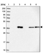 Lane 1: Marker [kDa] 250, 130, 95, 72, 55, 36, 28, 17, 10_br/_Lane 2: Human cell line RT-4_br/_Lane 3: Human cell line U-251MG sp_br/_Lane 4: Human plasma (IgG/HSA depleted)_br/_Lane 5: Human liver tissue_br/_Lane 6: Human tonsil tissue