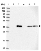 Lane 1: Marker [kDa] 250, 130, 95, 72, 55, 36, 28, 17, 10_br/_Lane 2: Human cell line RT-4_br/_Lane 3: Human cell line U-251MG sp_br/_Lane 4: Human plasma (IgG/HSA depleted)_br/_Lane 5: Human liver tissue_br/_Lane 6: Human tonsil tissue