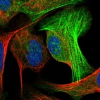 Immunofluorescent staining of human cell line U-2 OS shows localization to cytosol & actin filaments.