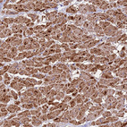 Immunohistochemical staining of human heart muscle shows strong granular cytoplasmic positivity in cardiomyocytes.
