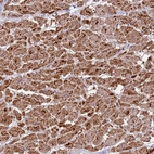 Immunohistochemical staining of human heart muscle shows strong granular cytoplasmic positivity in cardiomyocytes.