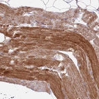 Immunohistochemical staining of human skeletal muscle shows strong granular cytoplasmic positivity in myocytes.