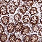 Immunohistochemical staining of human colon shows strong granular cytoplasmic positivity in glandular cells.