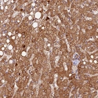 Immunohistochemical staining of human liver shows strong granular cytoplasmic positivity in hepatocytes.