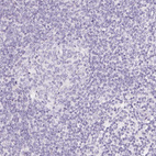 Anti-SLC5A2 Antibody