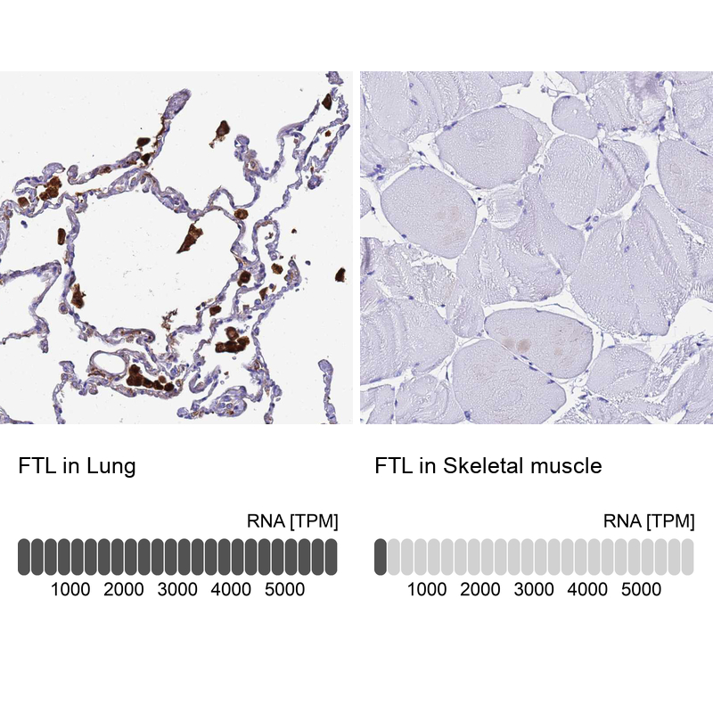 Anti-FTL Antibody