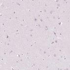 Anti-SLC5A2 Antibody