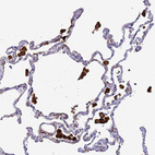 Immunohistochemical staining of human lung shows strong cytoplasmic positivity in macrophages.