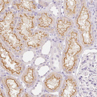 Immunohistochemical staining of human kidney shows moderate positivity in apical membrane in cells in tubules.