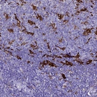 Immunohistochemical staining of human tonsil shows strong cytoplasmic positivity in germinal center cells.