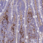 Immunohistochemical staining of human duodenum shows strong cytoplasmic positivity in lymphoid cells.